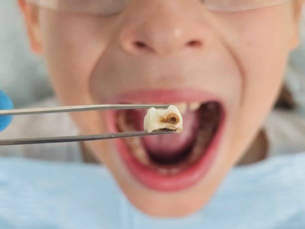 Best Emergency Tooth Extraction  in Petoskey, MI